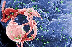 อนุภาคสีเขียวขนาดเล็กของเชื้อ HIV ล้อมรอบเซลล์สีชมพูและสีฟ้า