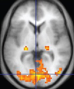 ภาพ fMRI แสดงสมองจากมุมมองด้านบน โดยบริเวณที่มีการทำงานของสมองถูกระบายสีส้ม
