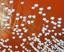 เบิร์คโฮลเดอเรีย