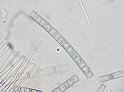 Aulacoseira