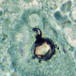 Paracoccidioides brasiliensis