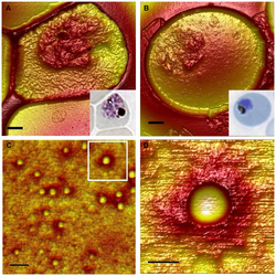 โปรตีนเยื่อหุ้มเซลล์เม็ดเลือดแดงของเชื้อPlasmodium falciparum 1