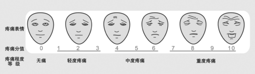 ระดับความเจ็บปวด