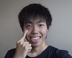 อากันเบ