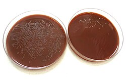 โคโลนีของ Neisseria gonorrhoeae บนจานเพาะเชื้อแบคทีเรียแบบวุ้น