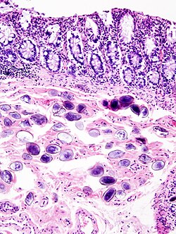 Schistosoma japonicum