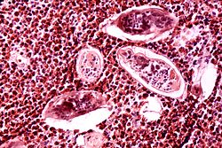 พยาธิใบไม้ในเลือด (Schistosoma haematobium)